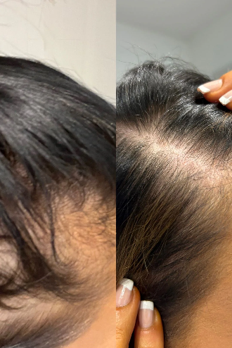 Vani-T Gloss Hair Growth Conditioner